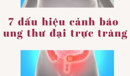 7 dấu hiệu cảnh báo ung thư đại trực tràng
