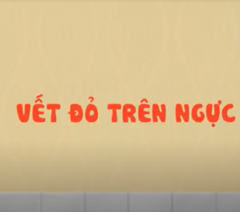 Vết đỏ trên ngực